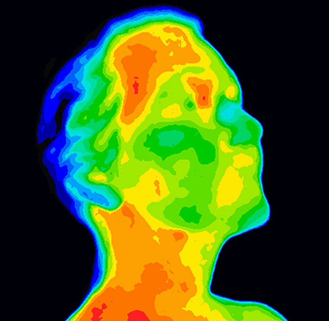 SpectralMD’s wound imaging system in use